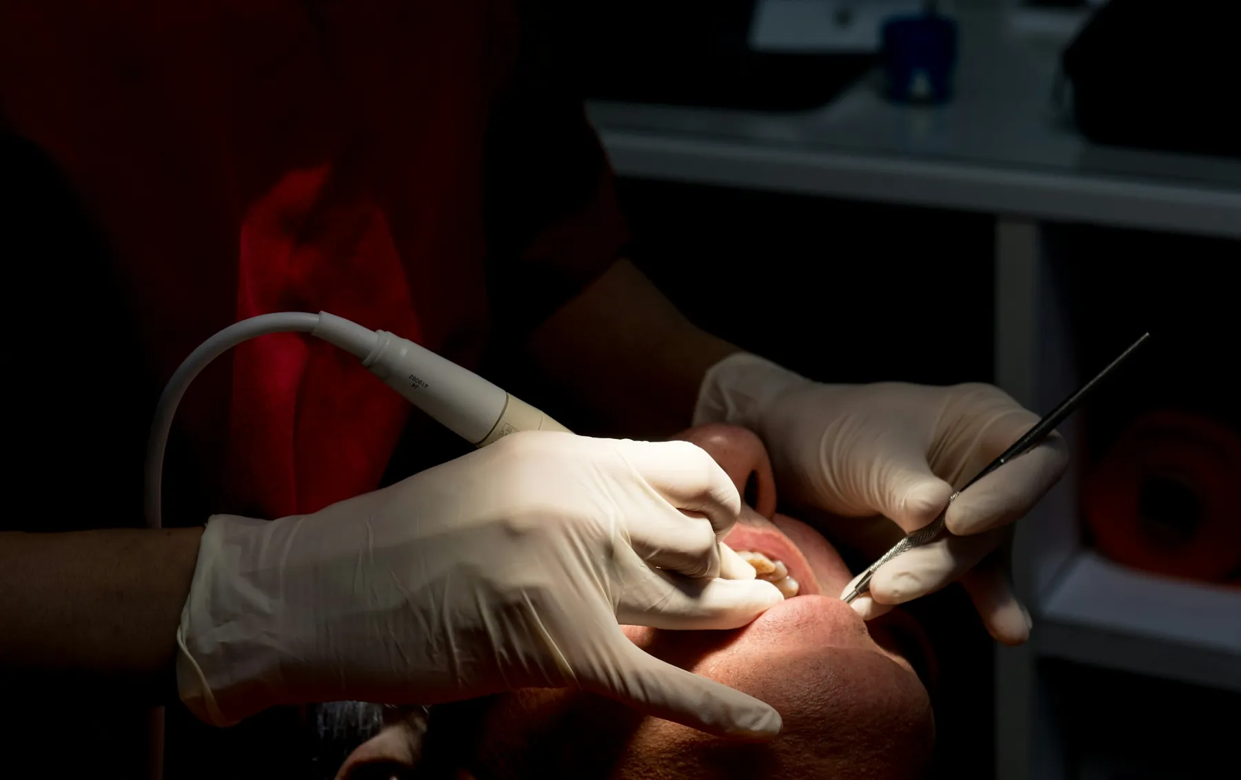 Dentist's gloved hands working under a single lamp